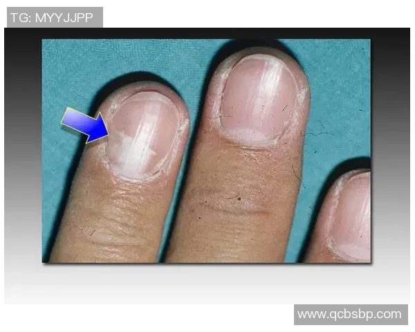 足球员指甲的秘密：如何影响比赛表现与运动员健康